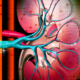 Enhancing Renal Function: A Revolutionary Approach with Axillary Mechanical Circulatory Support